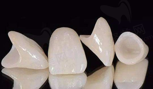 德国威兰德全瓷牙