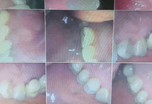 广信美维阳光口腔门诊部怎么样