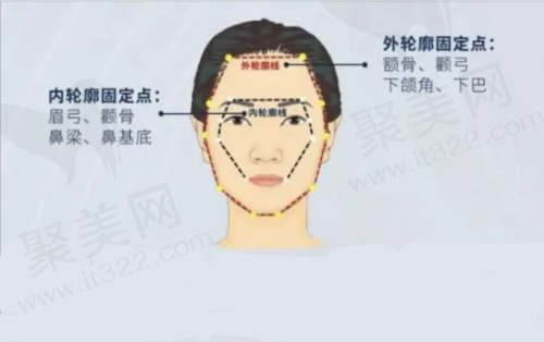 轮廓固定是什么