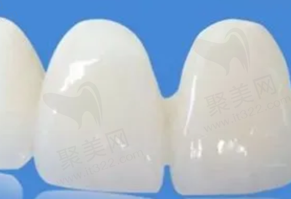 二氧化锆全瓷牙和烤瓷牙有什么区别
