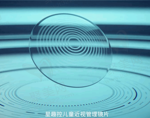 如何选购星趣控镜片？