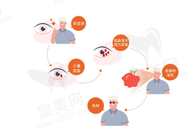 玻璃体后脱离对视力造成的危害