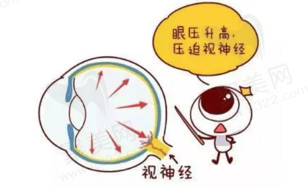 急性青光眼如何急救