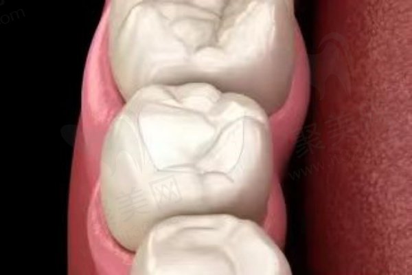 再来看看普通3M树脂补牙和纳米3M树脂补牙的区别