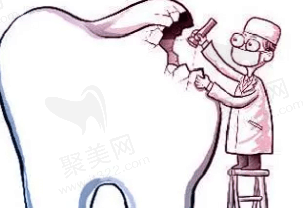 补牙会疼吗
