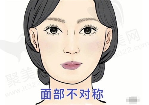 沈阳杏林整形外科朱石江做下颌角怎么样？