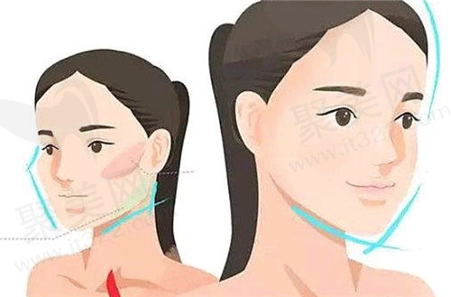 沈阳杏林整形朱石江医生做颌面手术多少钱？