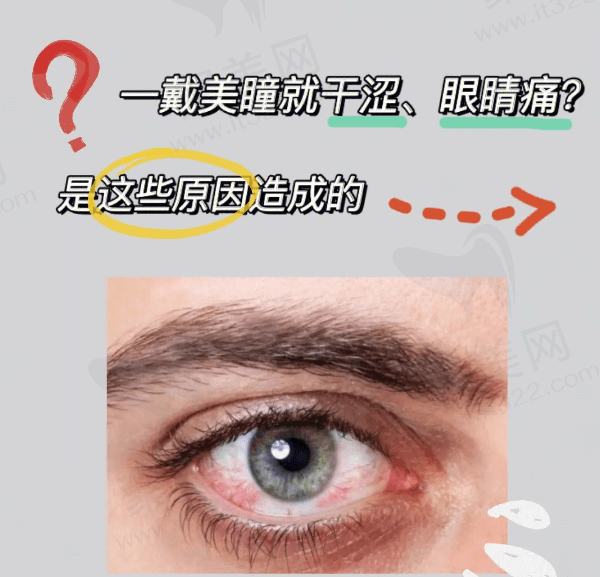 长期戴美瞳对眼睛会造成什么后果？