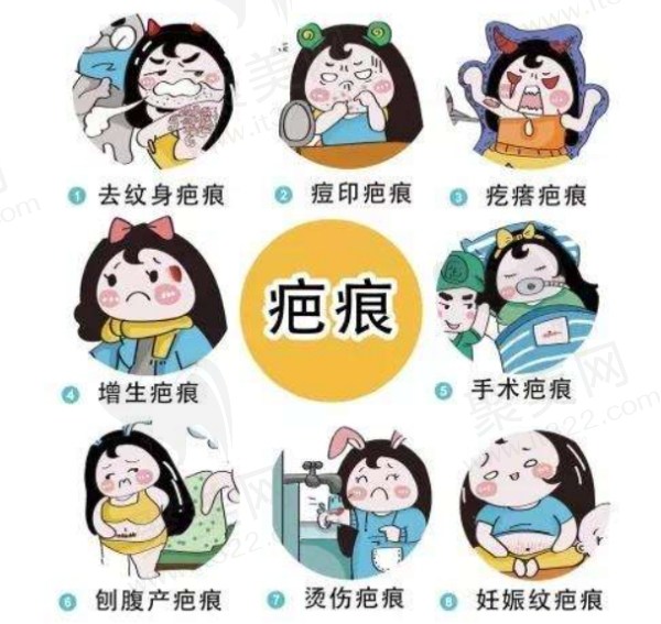 于艳菊医生做疤痕手术经验非常丰富