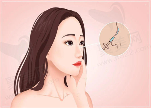 北京嘉禾整形医院做鼻子多少钱