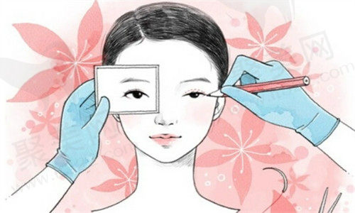 成都林靖医生双眼皮修复