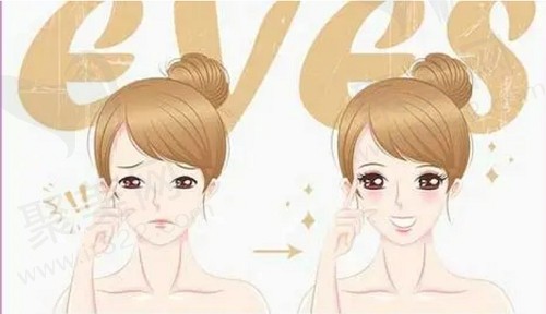 成都林靖修复后的眼睛自然吗