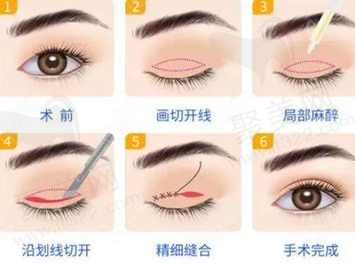 杜园园是不是营销出来