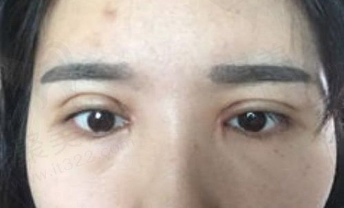 杜园园医生的成功范例