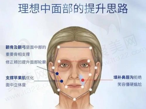 蒋铮铮轮廓固定手术的细节管控