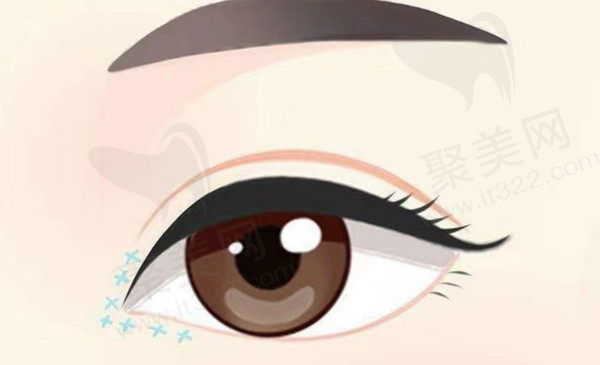 兰州时光激光整形美容