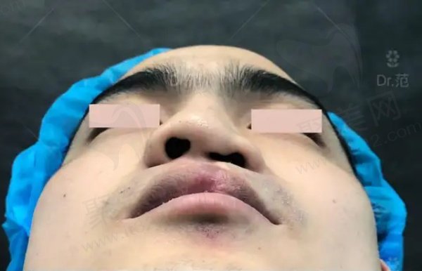 上海范锴医生手术病例