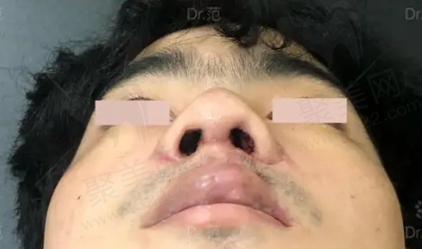 上海范锴医生手术病例