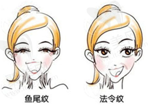 沈阳杏林整形医院张宇夫拉皮怎么样？