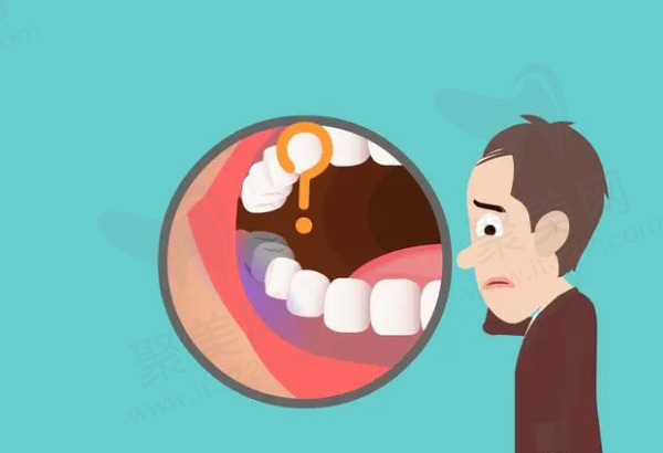 牙龈发紫黑是怎么回事