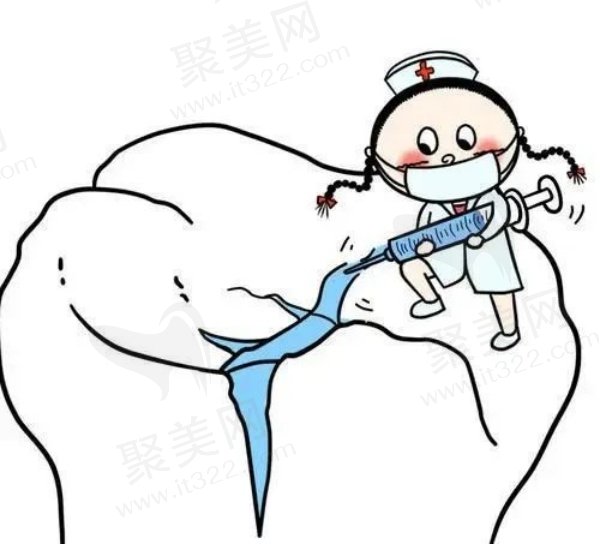 窝沟封闭的注意事项