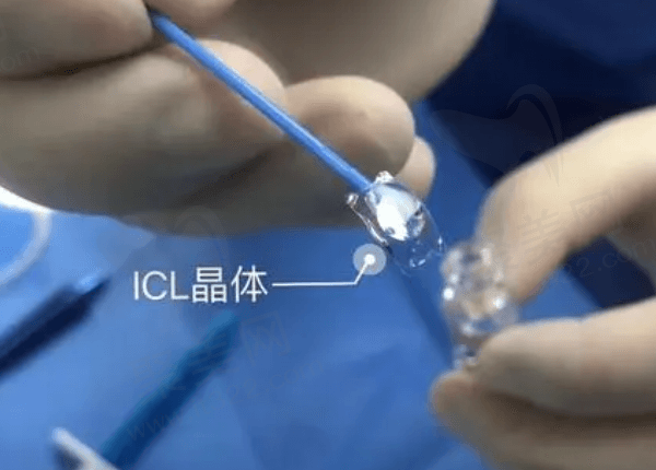 南宁爱尔眼科医院全飞秒SMILE手术矫正优势