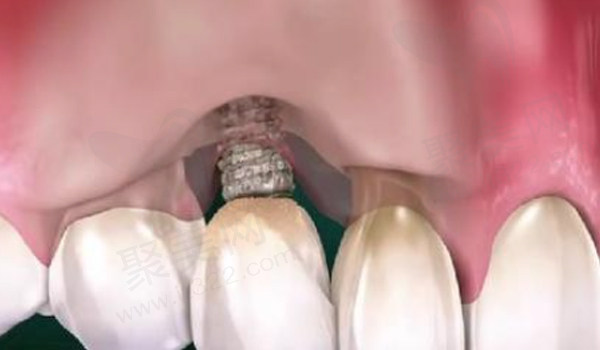 吸烟后引发炎症