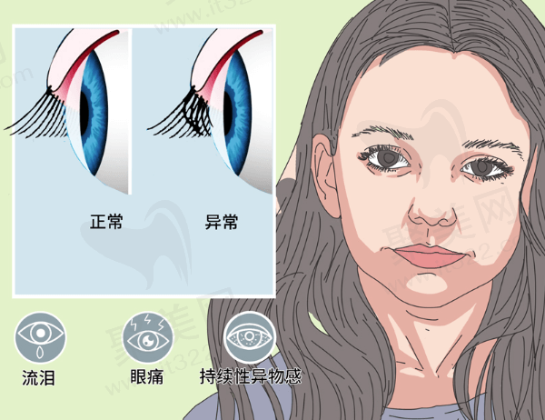 全飞秒每100度削多少角膜？