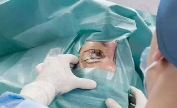 白内障手术是两只眼睛一起做吗