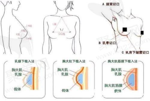 南京美莱夏建军怎么样