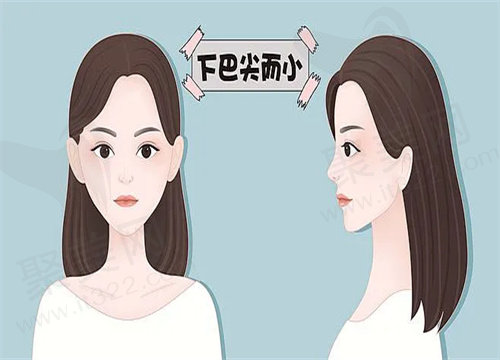 上海何晋龙磨骨审美好吗