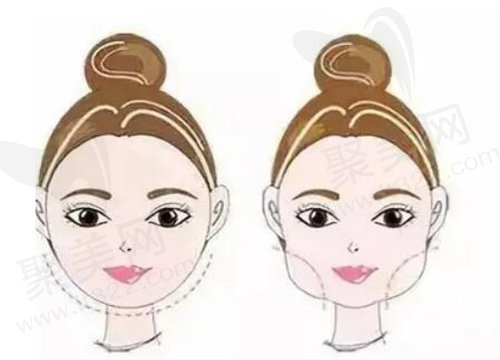 上海何晋龙磨骨审美好吗