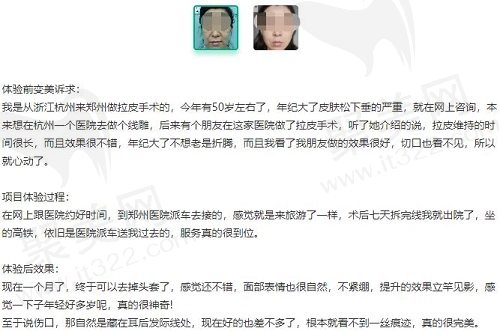 郑州魏广运拉皮多少钱