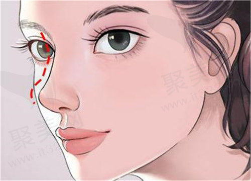 北京沃尔医院刘彦军怎么挂号