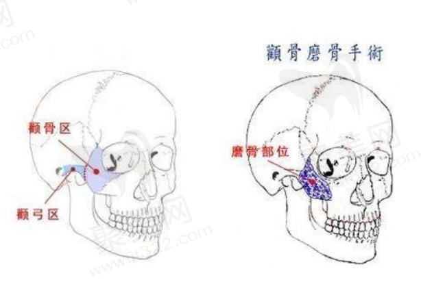 广东韩妃整形外科医院做颌面轮廓手术怎么样
