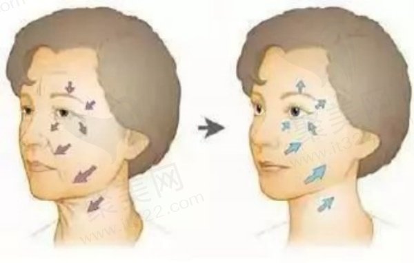 哈尔滨羽禅杨宇梓拉皮技术