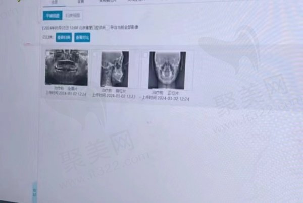 吴江美奥口腔医院陈剑飞做正畸口碑怎么样