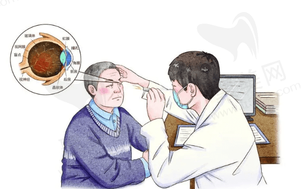 青光眼小梁手术复发率高吗？