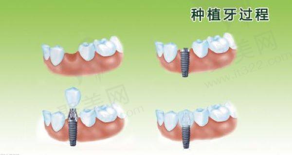 珠海牙科医疗保险报销政策