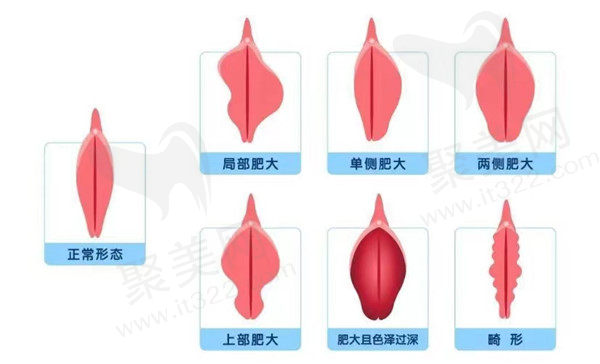 河南郑州第二中医院整形科