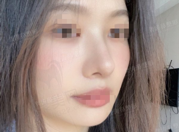 宁波雅韩宁悦龚涛医生鼻修复口碑好