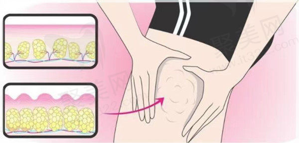 佛山顺德亚美医疗美容