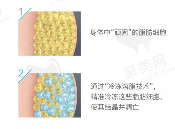 佛山超美医疗美容