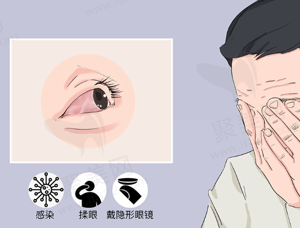 急性眼眶蜂窝织炎有什么症状? 