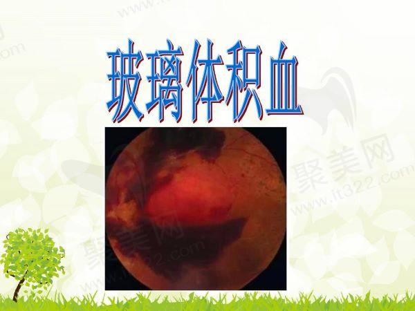 玻璃体积血有什么症状
