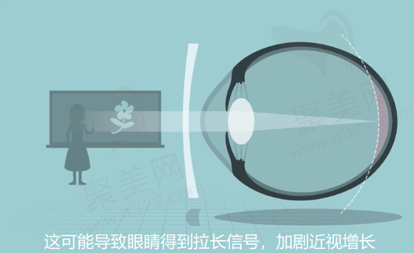 离焦镜能控制近视吗？