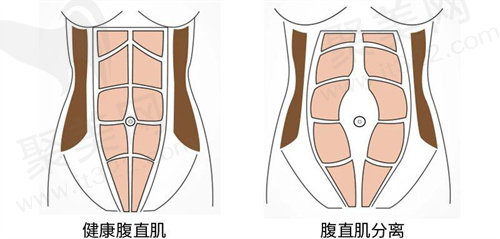 国内腹壁成形医院排名榜前十