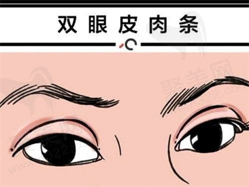 刘志刚眼修复怎么挂号?
