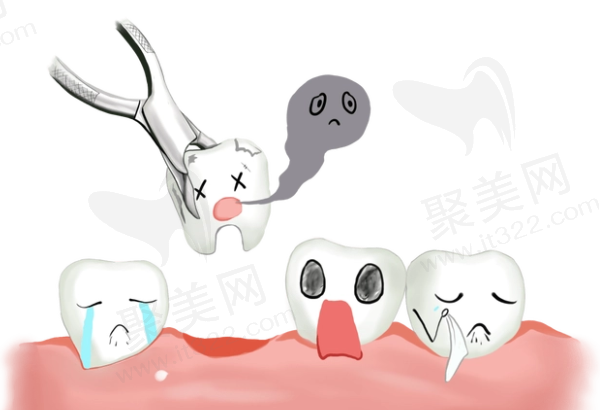 得过脑梗的人拔牙需要注意什么