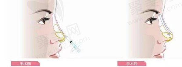 曲靖韩美医疗美容医院